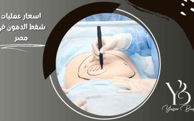اسعار عمليات شفط الدهون في مصر