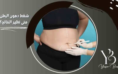 شفط دهون البطن | متى تظهر النتائج؟
